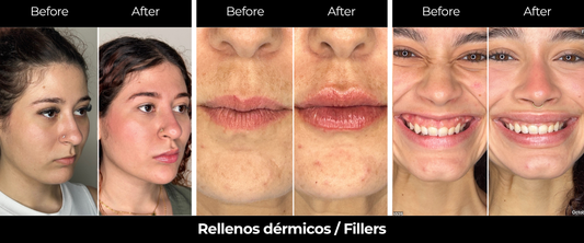 Medicina Estética Segura en Puerto Rico: Nefer Aesthetic Clinic